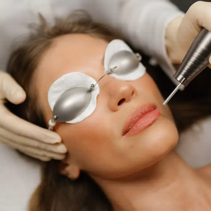 Woman receiving laser eye treatment with protective goggles on a white background